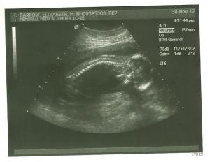 ultrasound3